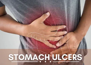 Ulcer problem Result